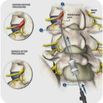 how to fix joint pain