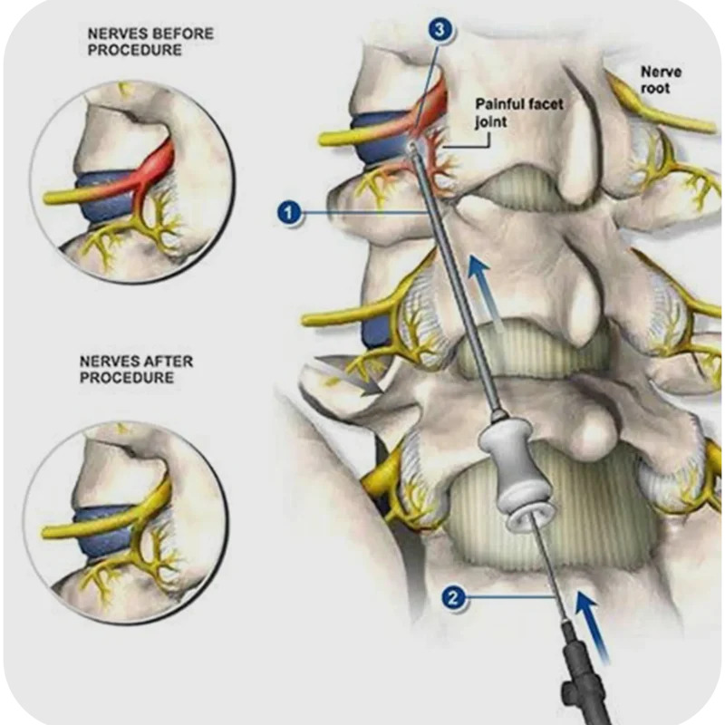 how to fix joint pain